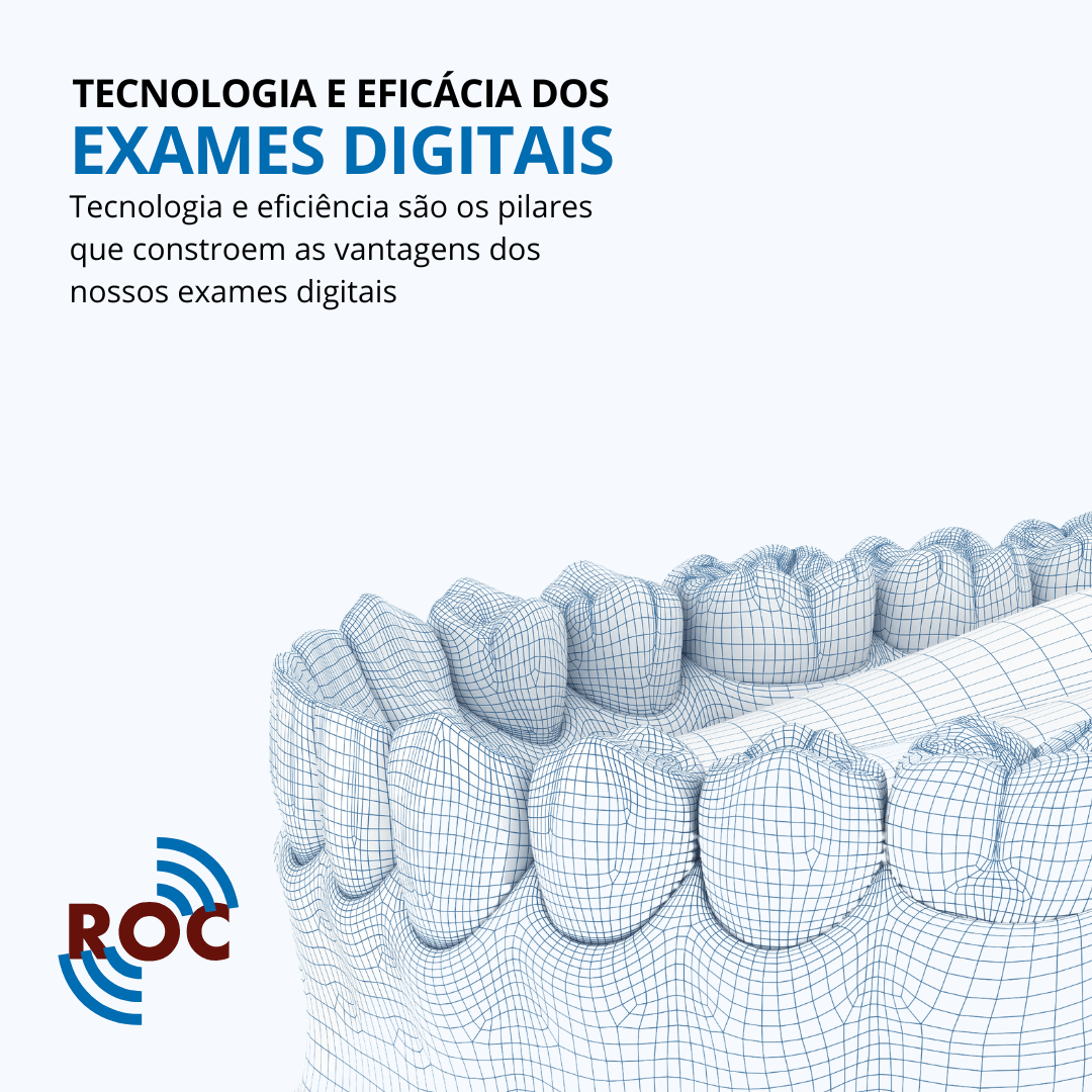 Ilustração de uma arcada dentária inferior