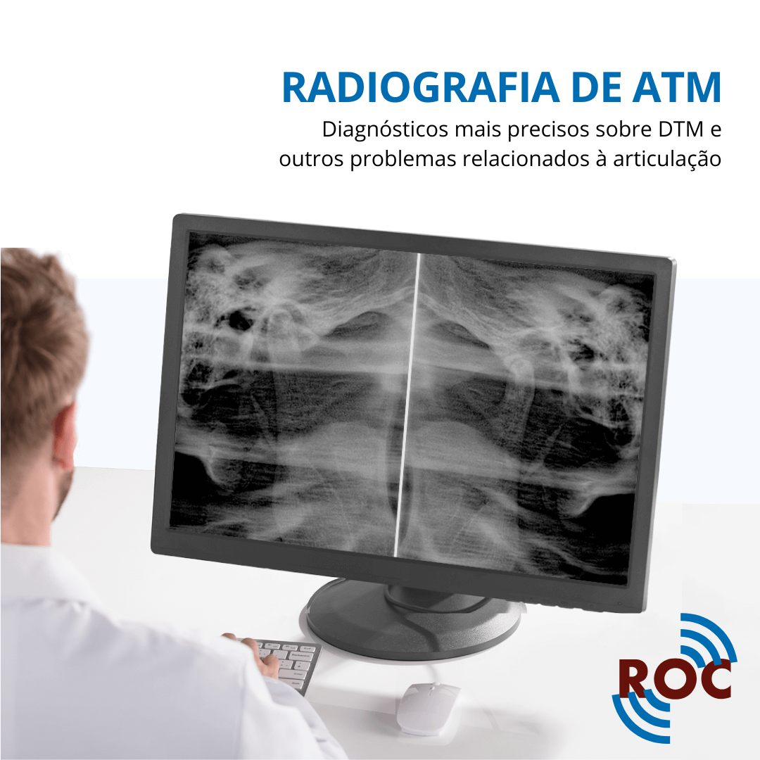Radiologista observando uma radiografia de ATM