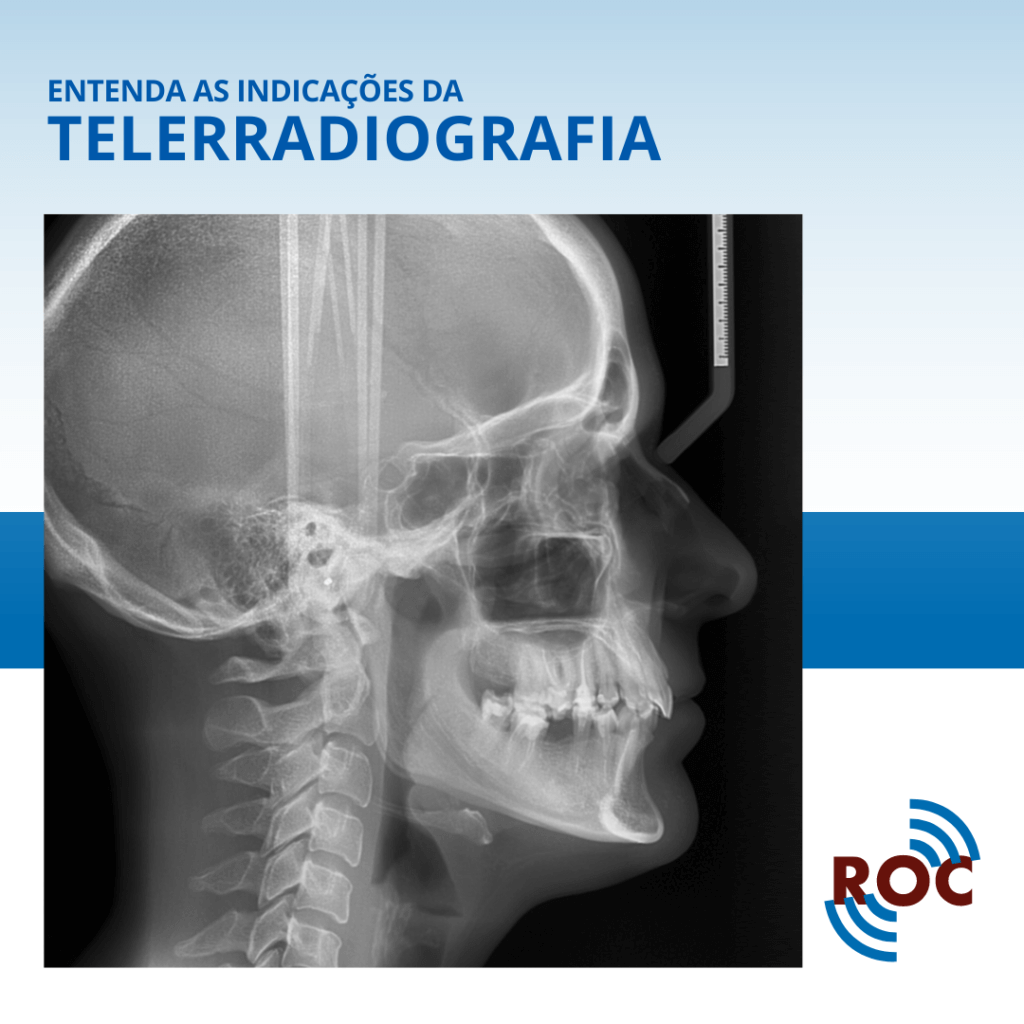 Temora Radiography Entenda as Indicações da Telerradiografia - ROC
