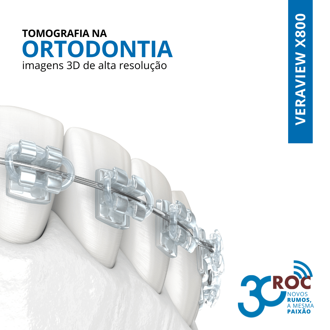 Ilustração de dentes com aparelho ortodôntico