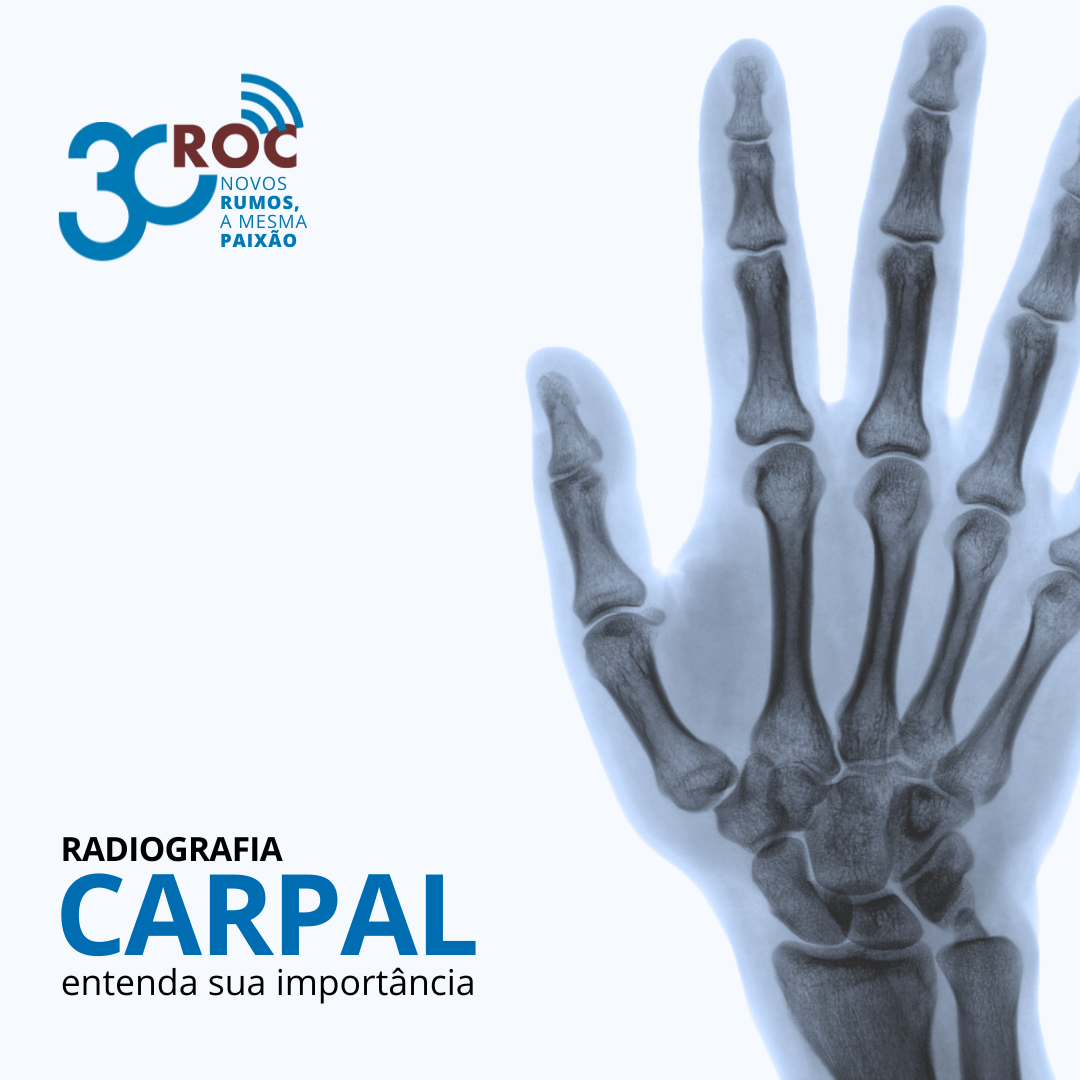 Imagem de uma radiografia carpal