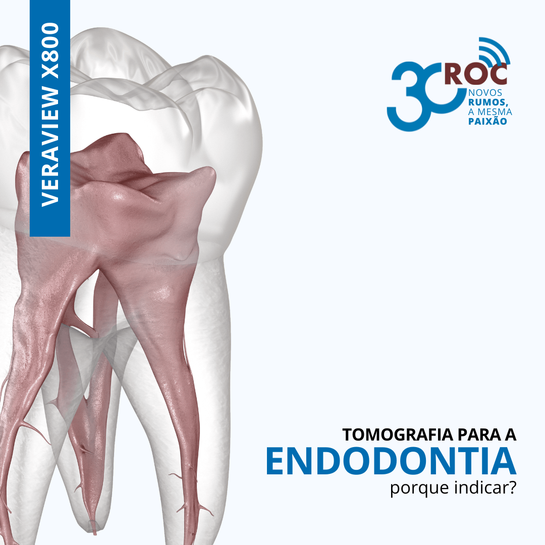 Ilustração do revestimento interno de um dente