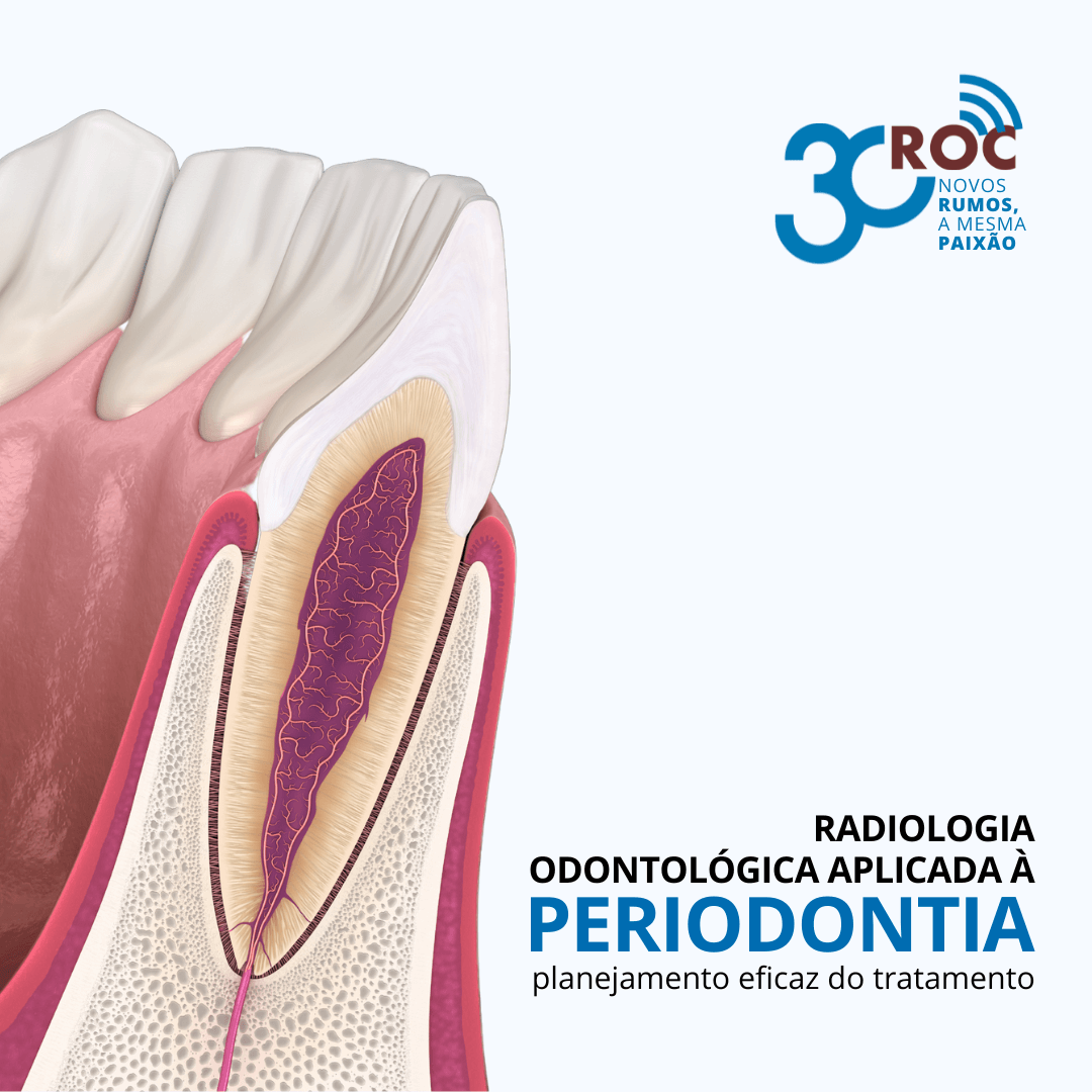 Ilustração da parte interna do dente e gengiva circundante