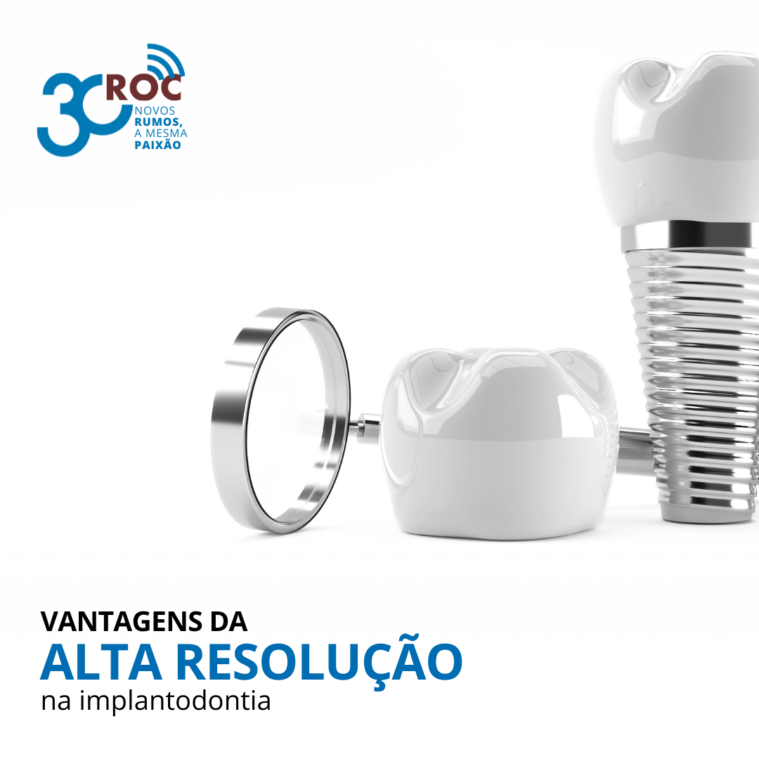 Ilustrações de implantes dentários