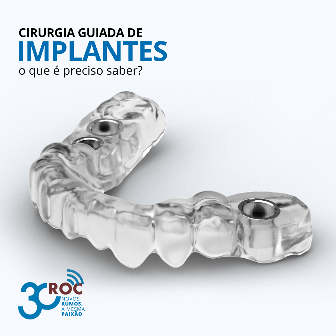 Guia cirúrgico para implantodontia