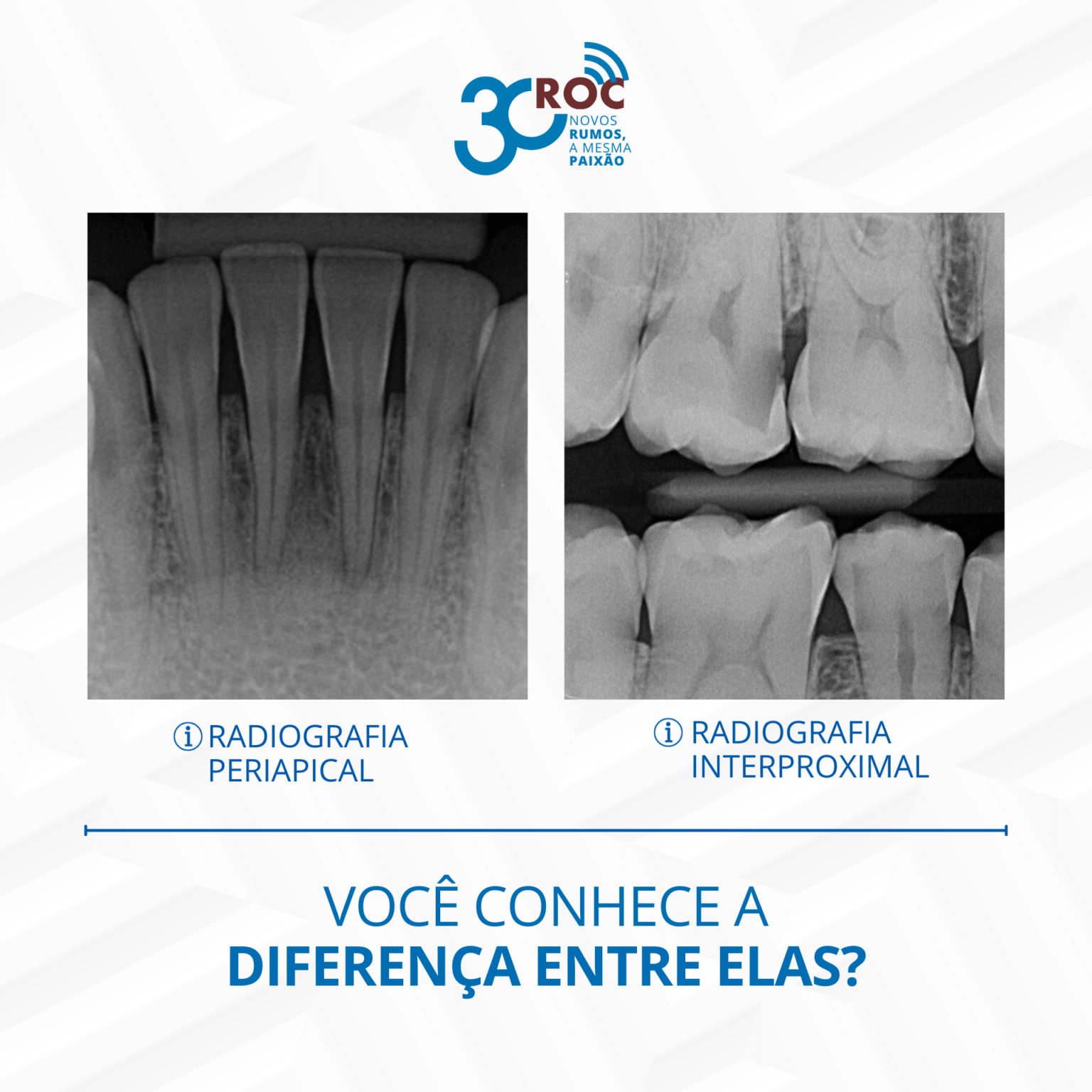 Radiografia periapical x Radiografia interproximal, você conhece a ...